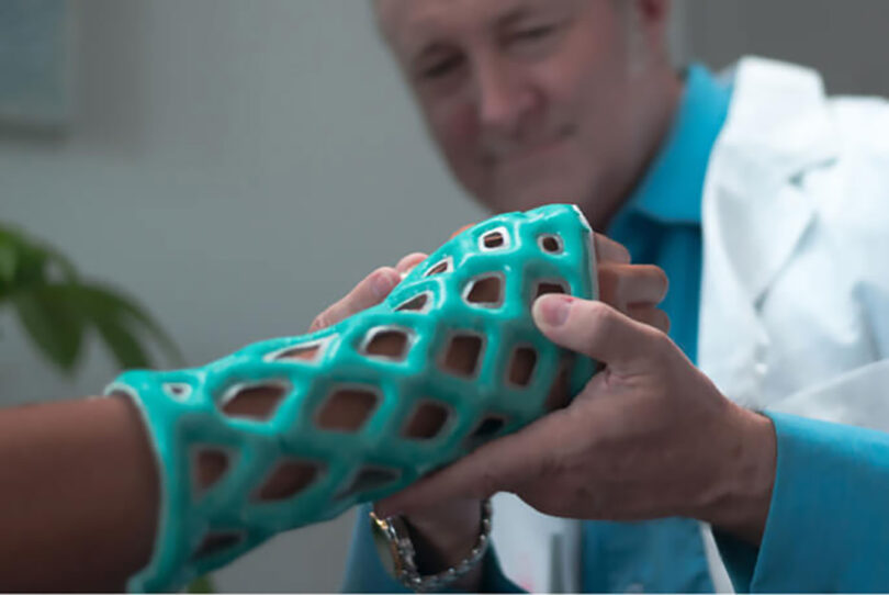 Doctor inspected a teal Cast21 orthopedic sleeve on patient's arm.